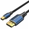 Кабель Displayport Vention HCFLH Чёрный 2 m