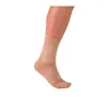 Medilast Ankle Brace With Toe Cap Trauma Plus Small Size 